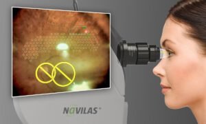 OD OS Navilas 577S